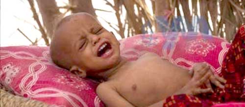 قربانی شدن ۱۰ هزار کودک یمنی