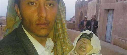 سعودی قاتل ۲۳ هزار نوزاد یمنی