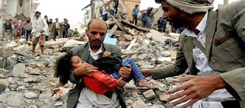 سناریوی ۳۰ روزه آمریکا برای قتل‌عام یمنی‌ها