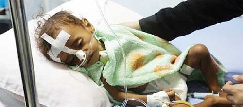 فوت ۶ نوزاد یمنی در هر دو ساعت