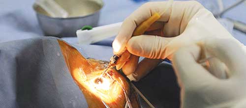 ۴۰۰ عمل جراحی چشم روز پنجشنبه توسط متخصصان چشم پزشکی کشور در بیمارستان فارابی تهران انجام شد كه رکورد دنیا را شکست