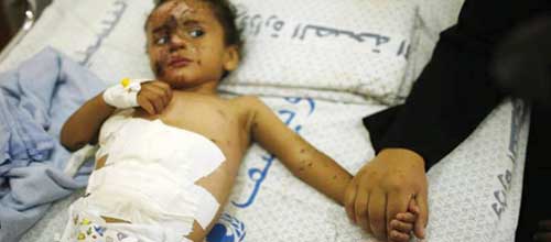 مبارزه بیماران یمنی با مرگ